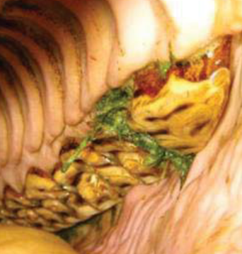 <p>What dental abnormality is this?</p>