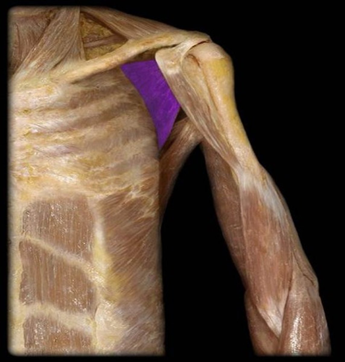 <p>medially rotates arm</p><p>-subscapular nerve</p>