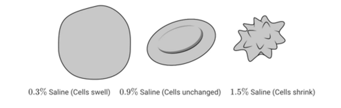 <p>Intravenous (IV) therapy is used for fluid replacement in instances of dehydration in humans and other animals. One type of IV fluid is essentially a saltwater solution. To determine the best concentration for therapy in people, a team of students is researching the effects of solutions of different salt concentrations on red blood cells. The following observations were made from three different red blood cell samples viewed under a microscope.<br><br>The team wants to extend the research project. What should the team of students do next to obtain data that are more conclusive?</p>