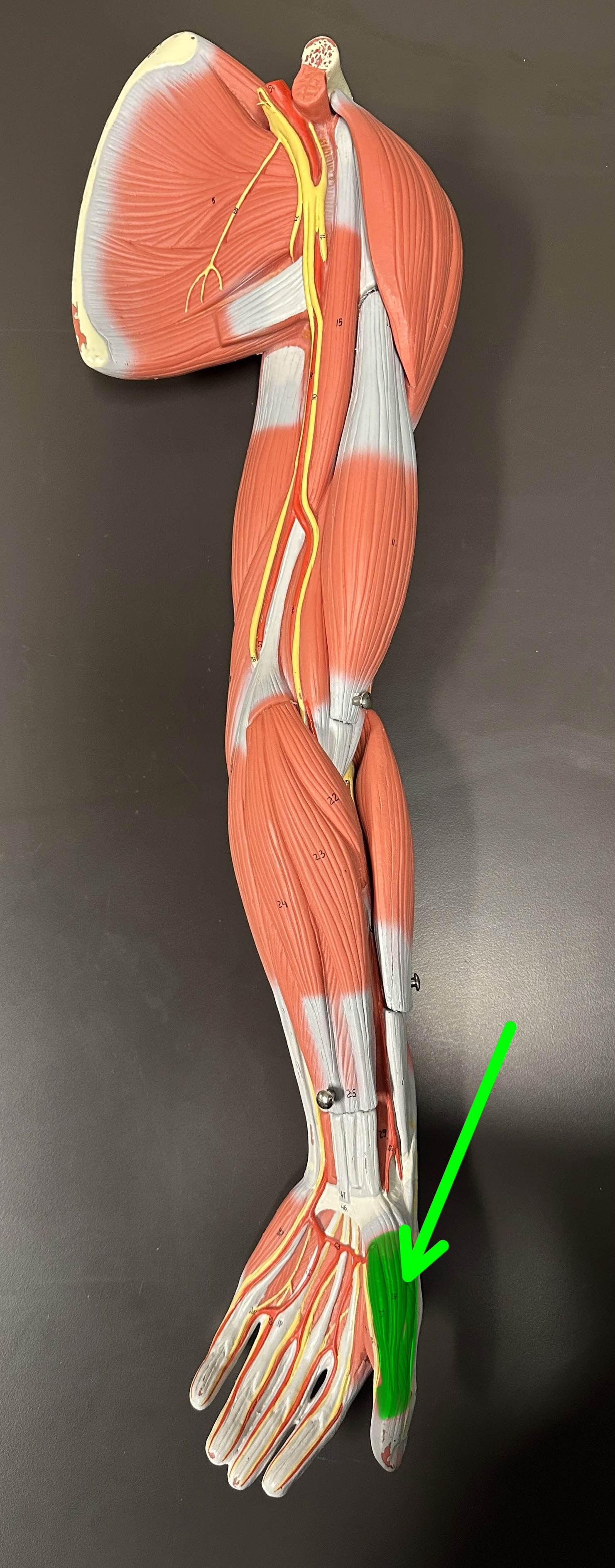 <p>What is the highlighted structure</p>