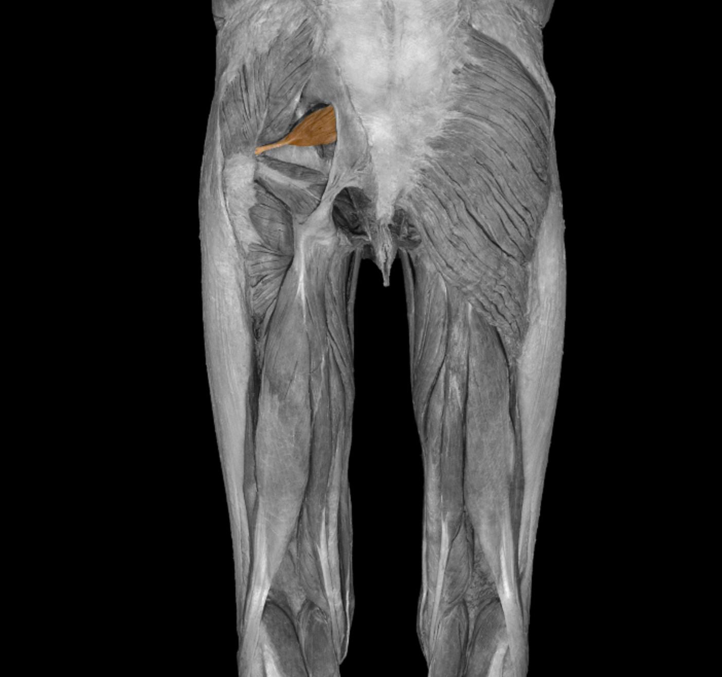 <p>superficial to sciatic nerve </p><p></p><p>origin: anterior sacrum</p><p></p><p>insertion: superior border of greater trochanter of femur</p><p></p><p>action: laterally rotate things, abduct thigh</p><p></p><p>innervation: S1, S2</p>