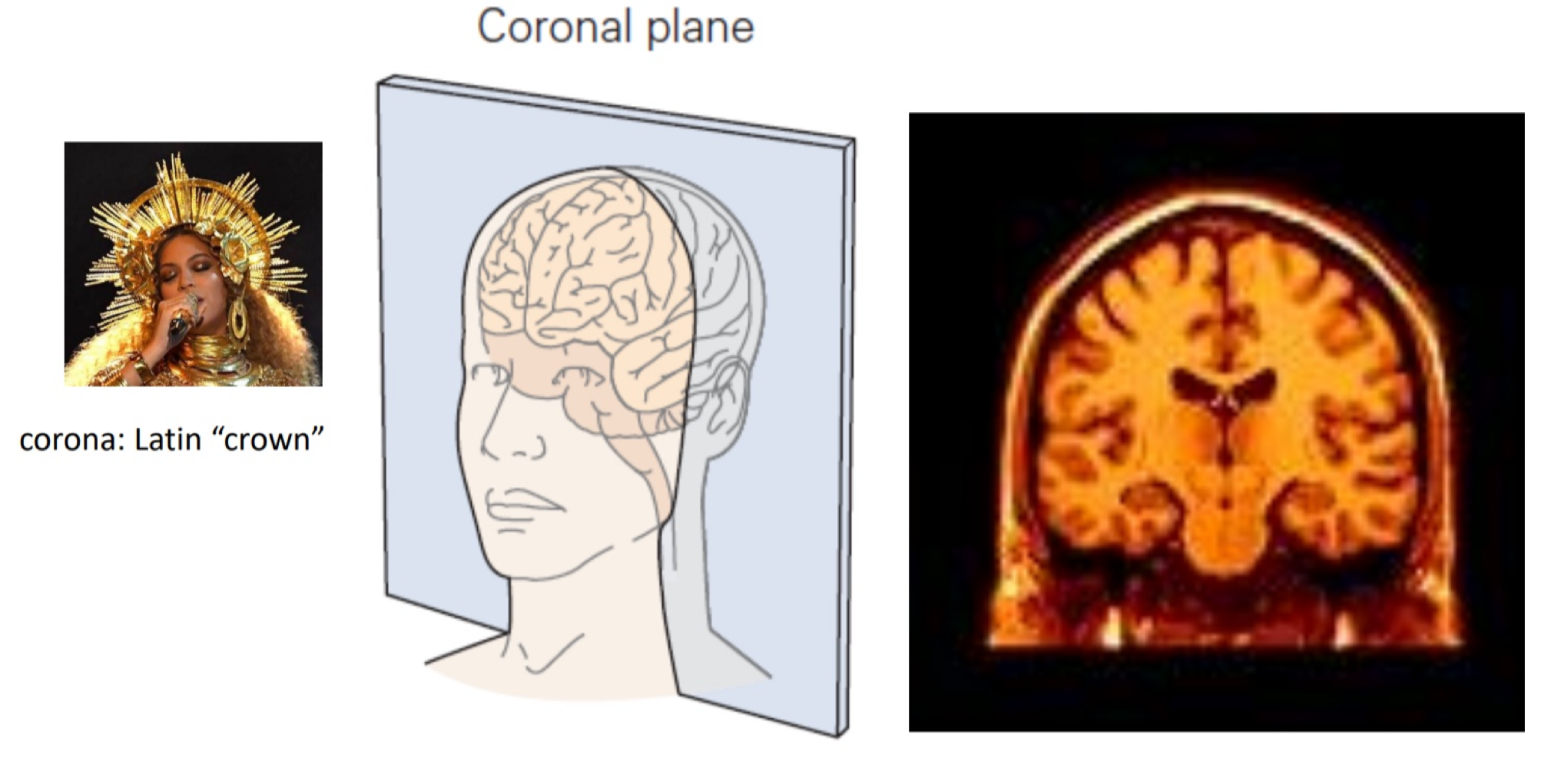 <p>like a latin crown, can see top of person’s head and maybe their neck&nbsp;</p>