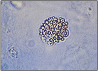 <p>lipid contain RTE cells</p>