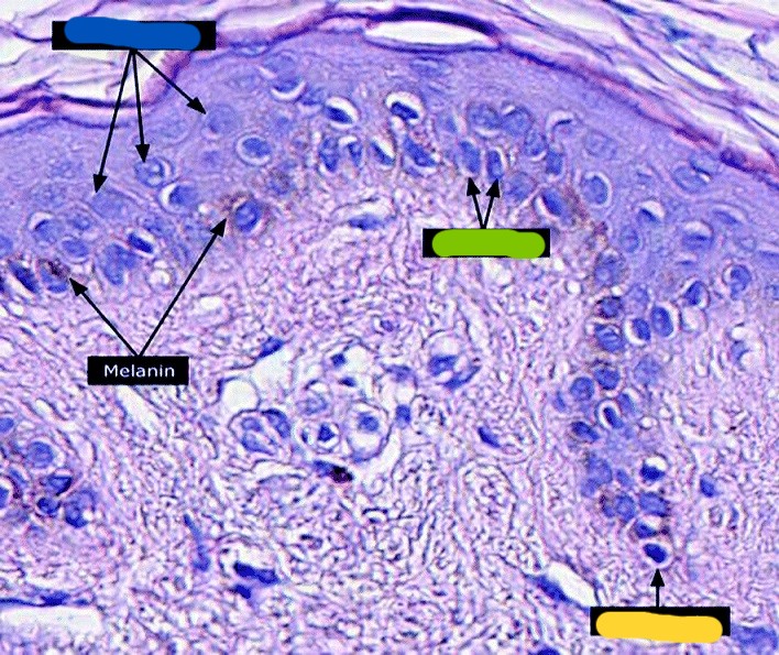 <p>What cells are crossed out in green? Describe them.</p>