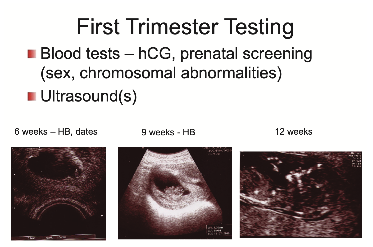 <ol><li><p>Blood tests - hCG, prenatal screening (sex, chromosomal abnormalities)</p></li><li><p>Ultrasound(s)</p></li></ol><p></p>