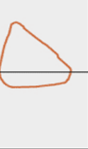 <p>what is this flow volume loop showing </p>