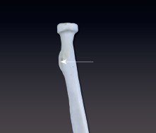 <p>larger, knoblike process</p>