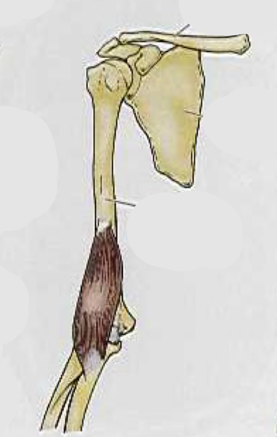 <p>What muscle is this?</p>