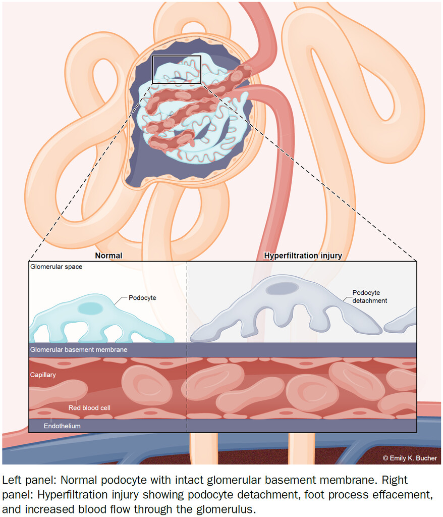 <p>3 layers</p><ul><li><p>Endothelium</p></li><li><p>Basement membrane</p></li><li><p>Podocytes</p></li></ul><p></p>