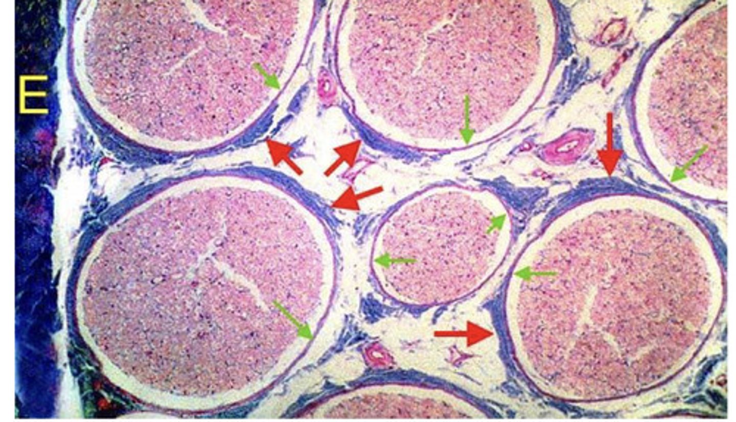 <p>the red arrows show what?</p>