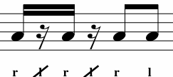 <p>What Variation is This? </p>