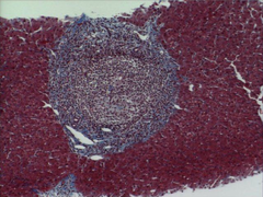 1.commonly linked with ready to eat food
2. found in the feces of infected pople
3. can produce a mild fever and general weeakness
4.purdchasing shellfish from an approved suplier is on way to prevent
5. causes jaundice