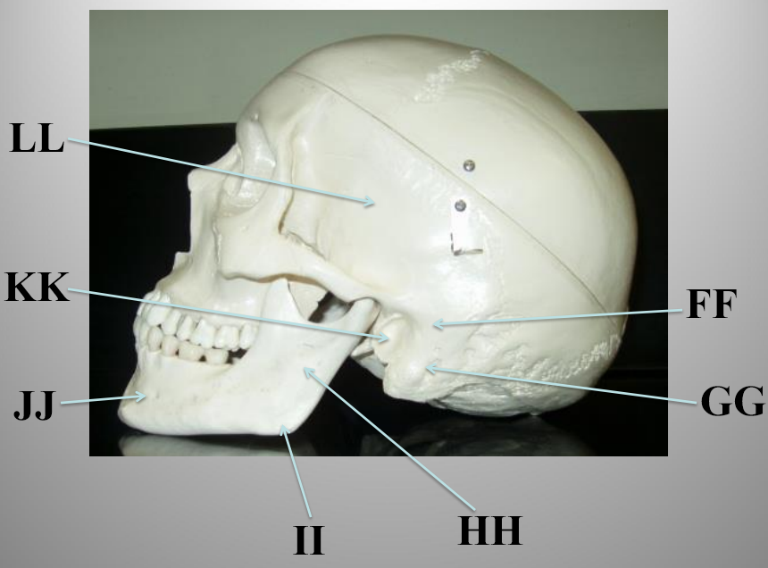 <p>What structure is letter FF?</p>