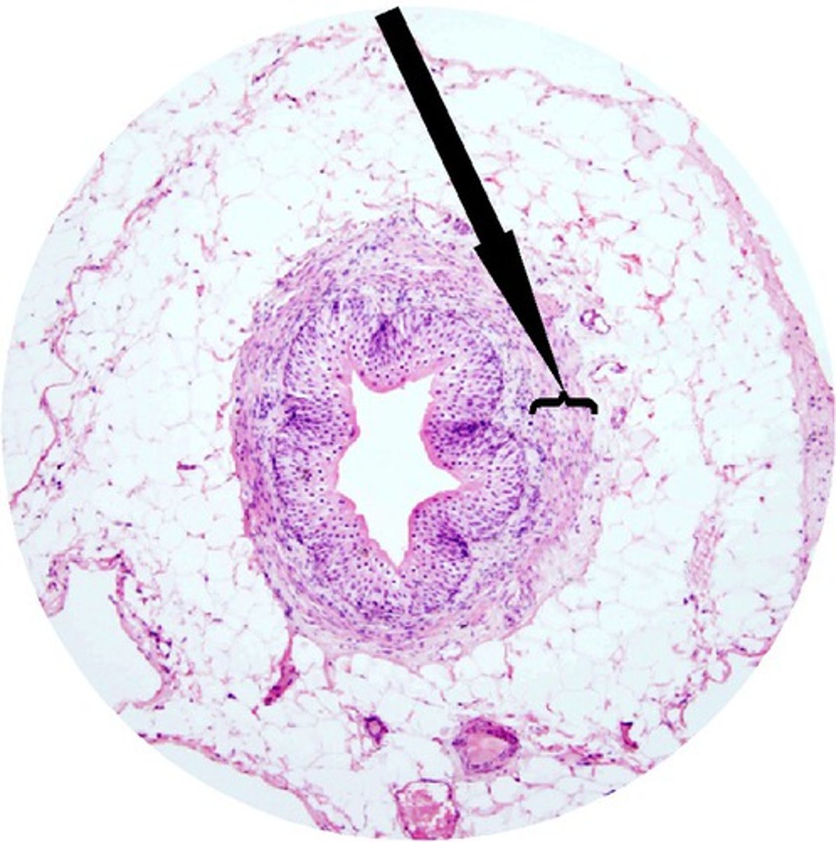 <p>Identify this urinary system structure.</p>