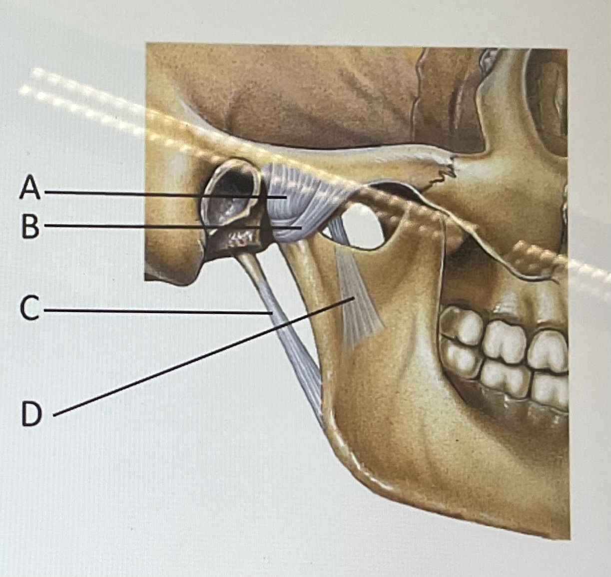 <p>identify the structure marked A</p>