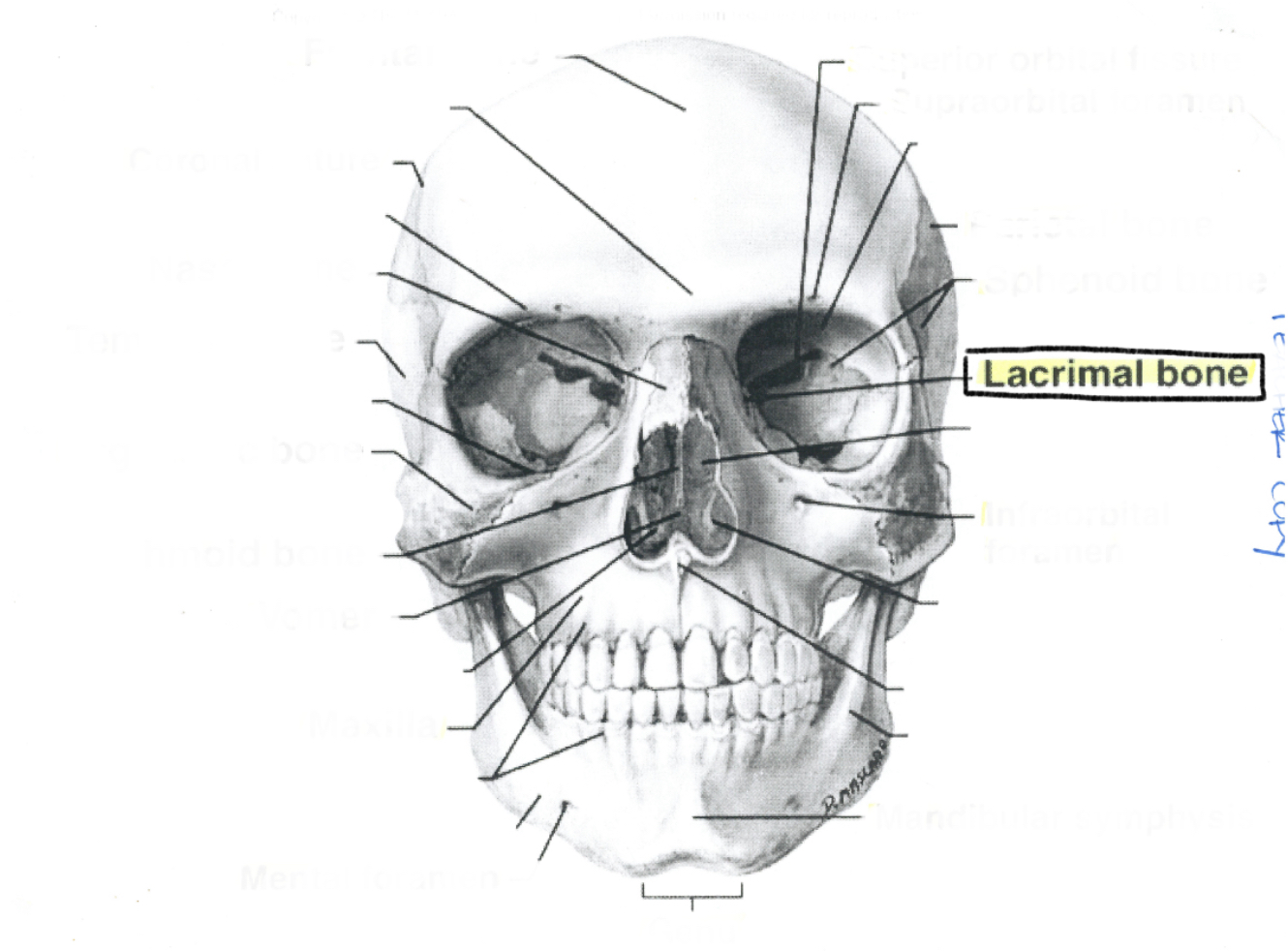 <p>Lacrimal bone</p>