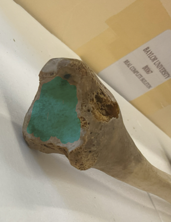 <p>What is the blue?</p>