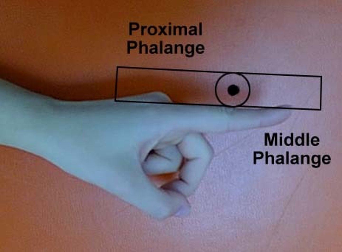 <p>interphalageal</p>