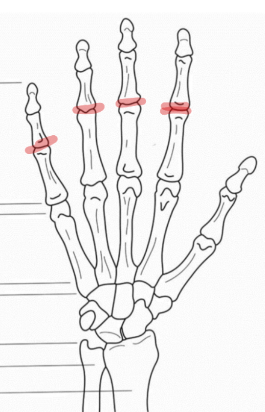 <p>Hoe noemt het gewricht dat tussen de proximale en de middenste falangen ligt</p>