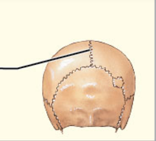 What structural category is this?

What functional category is this?