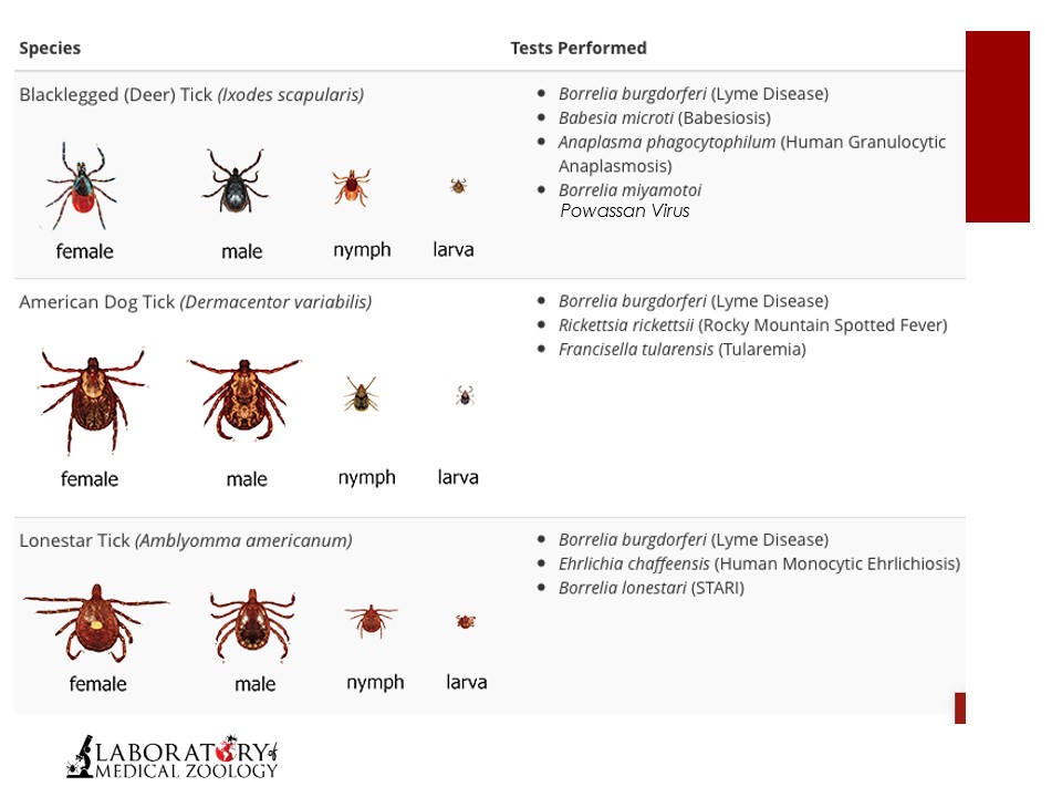 <p><strong>Which type of tick is the primary vector of Lyme disease in the United States?<br><br></strong></p><p style="text-align: justify">a) Lone star tick<br></p><p style="text-align: justify">b) Blacklegged tick<br></p><p style="text-align: justify">c) American dog tick<br></p><p>d) Brown dog tick<br></p>