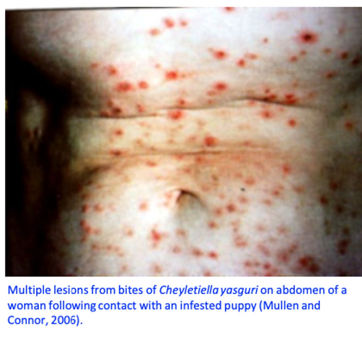 <p>Clinical signs</p><p>History </p><p>Detection of Cheyletiella mites or eggs might be difficult:</p><p>- Direct examination of the surface of the skin with magnifying glasses</p><p>- Superficial skin scrapings;</p><p>- Acetate tape impressions</p><p>- Combing (flea comb) or brushing of the hair</p><p>Sometimes the infestations are diagnosed because of the dermatitis caused by Cheyletiella spp. to the owners!!!</p>