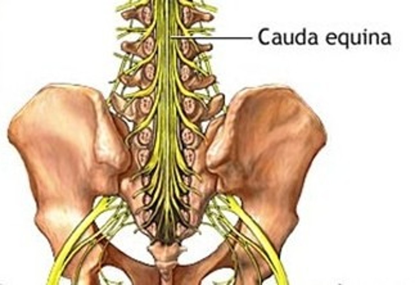 <p>Bundle of nerve roots at inferior end of vertebral canal is caudal equina</p>