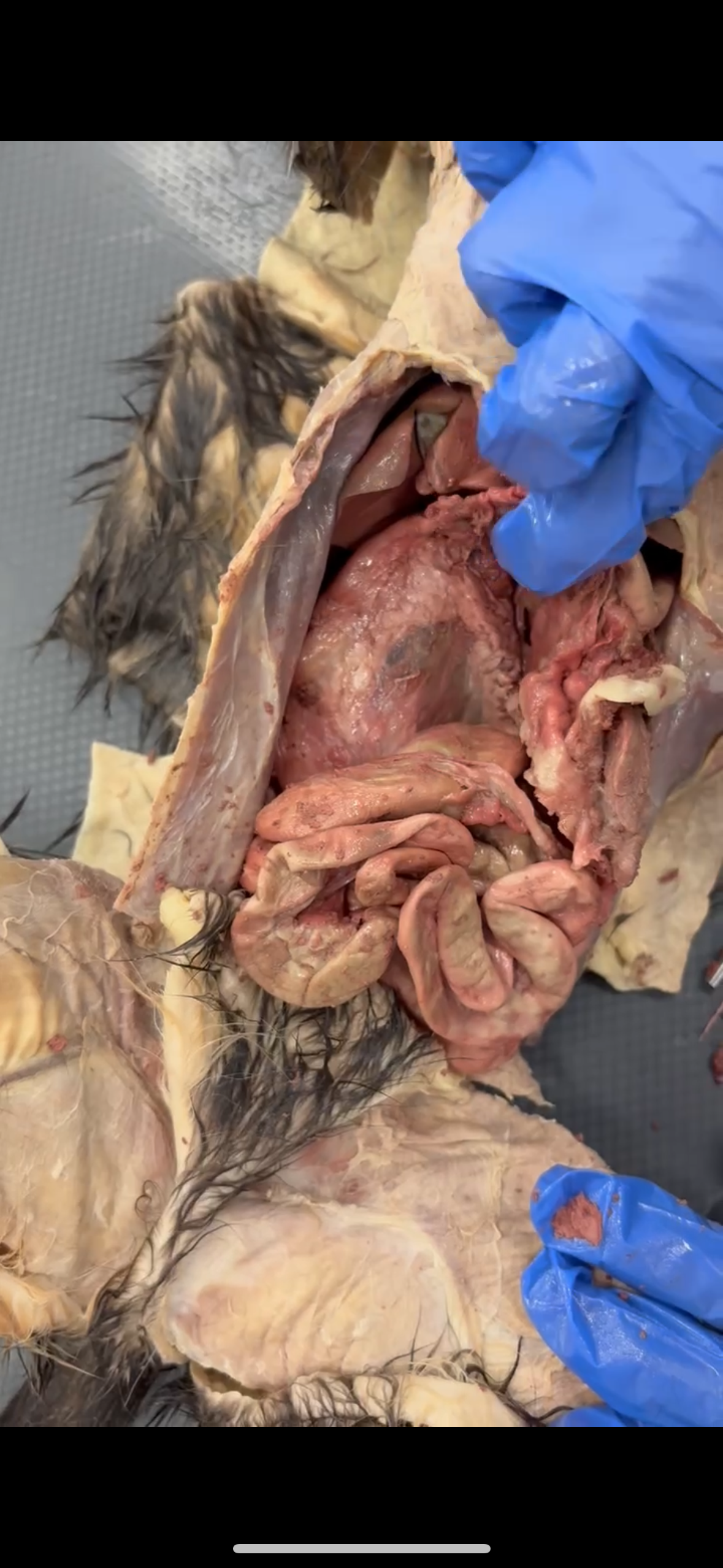 <p>What structure and part of structure is right below the finger</p>