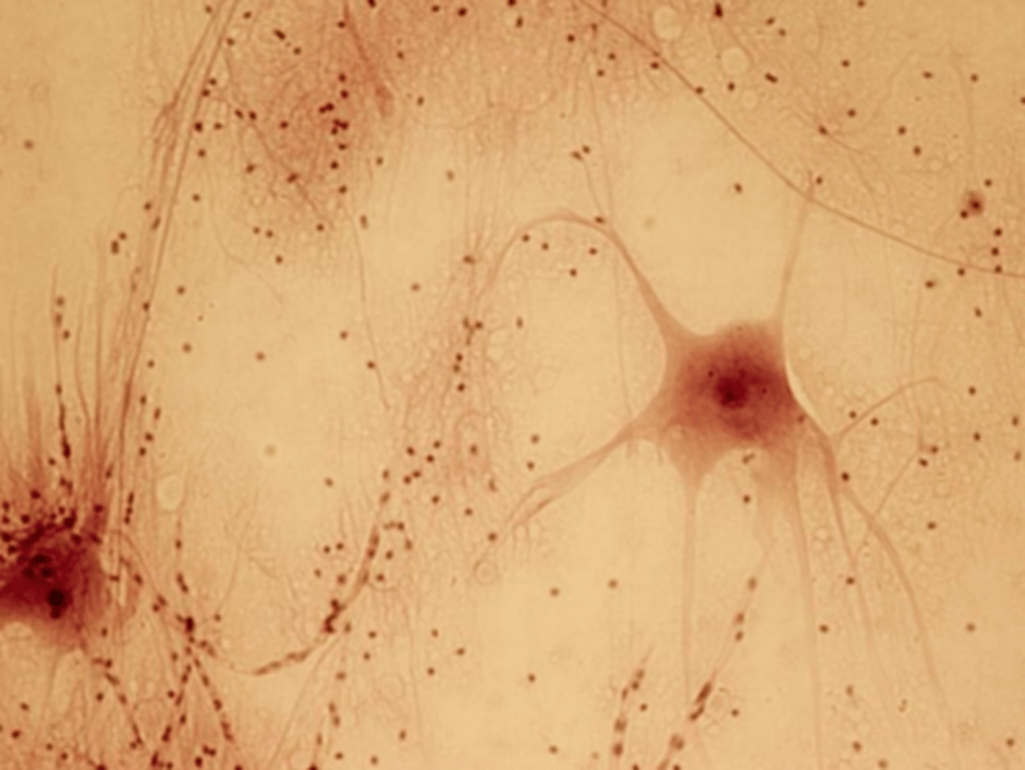 <p>A neuron</p>