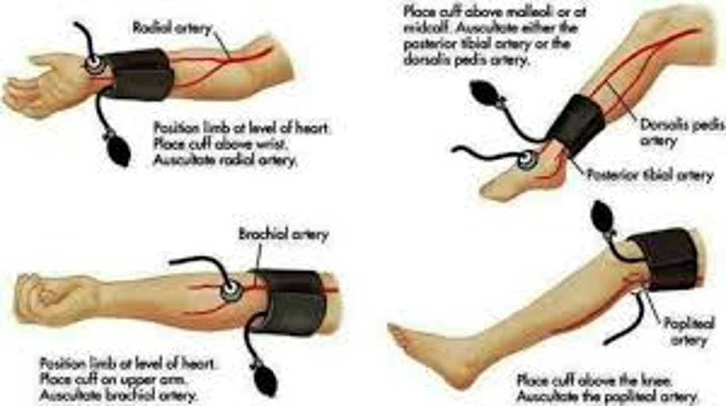 <p>Must hear pulse before inflating cuff in foot</p>