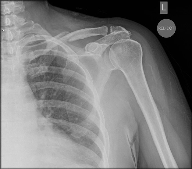 <p>Describe the abnormality demonstrated.</p>