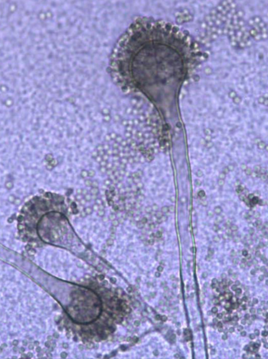 <p>Aspergillus fumigatus - konidiofory, zarodniki konidialne</p>