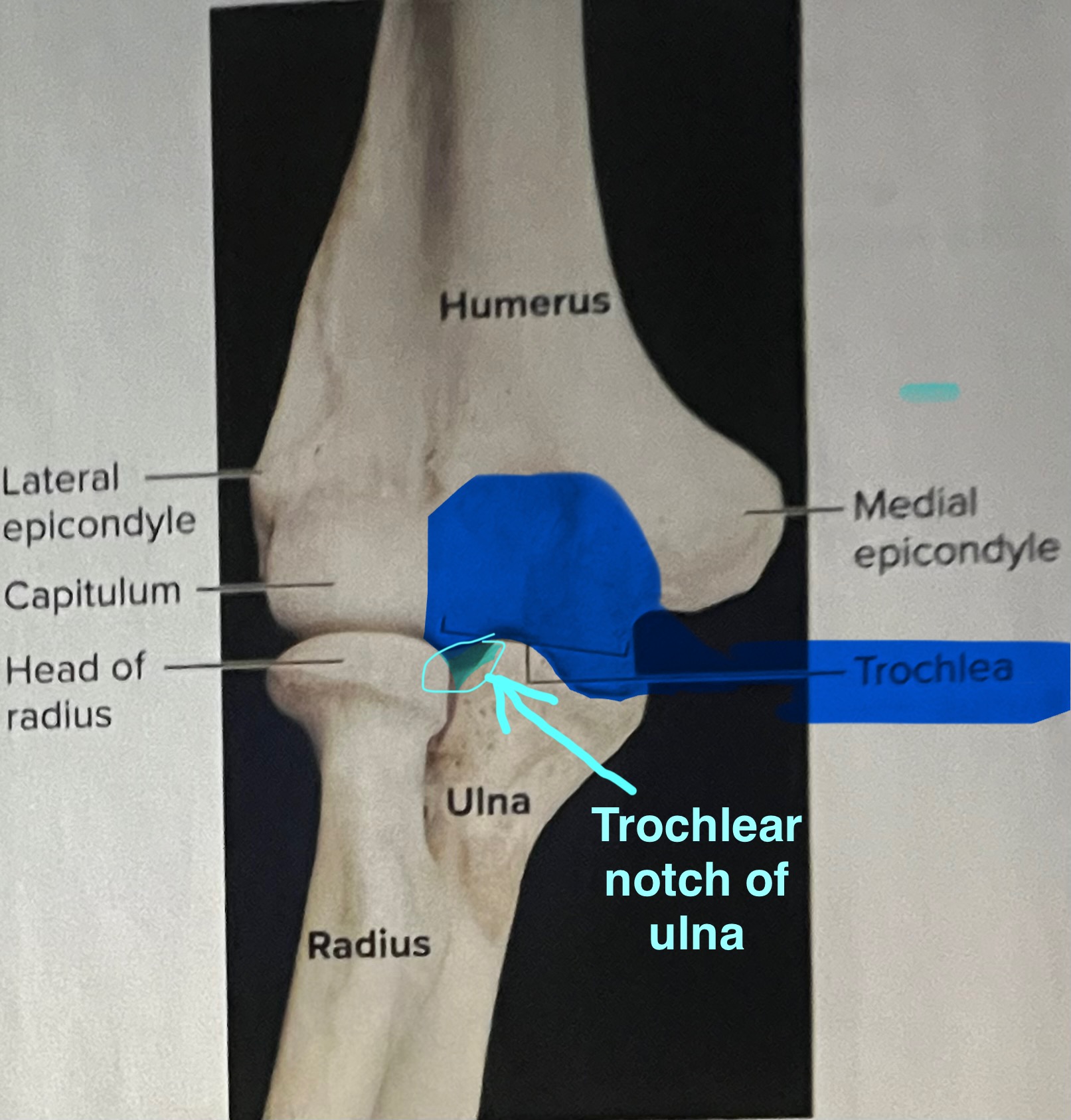 <p>Articulates with the trochlear notch of the ulna, forming the elbow joint</p>