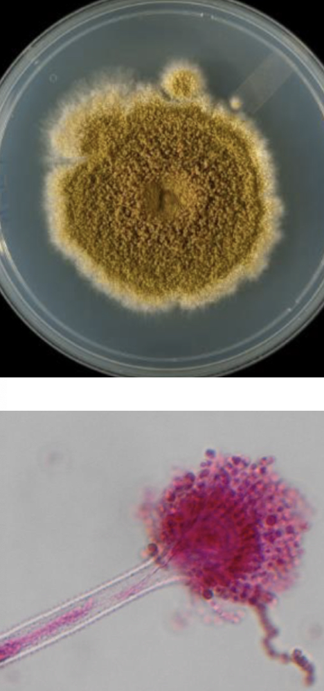 <p>Aspergillus Flavus</p>