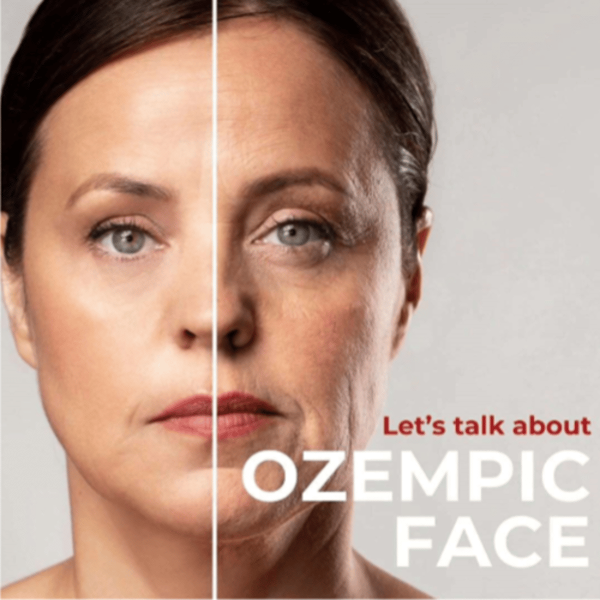 <p>(most relate to metabolic changes)</p><p>- appetite loss, followed usually by a lack of taste</p><p>- N&amp;V, constipation</p><p>- pancreatitis, cholecystitis (inflamed gallbladder), renal failure, thyroid tumors</p><p>- appearance "ozempic face" (lose all cushion, look hollowed out)</p>