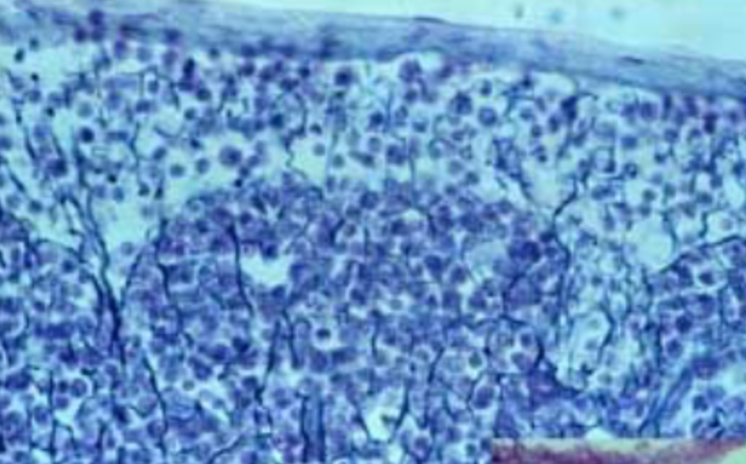 <p>Reticular (loose connective tissue)</p>