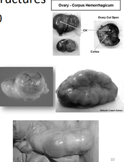 <p>·       Corpus hemorrhagicum (CH)</p><p>·       Corpus luteum (CL)</p><p>·       Corpus albicans (CA)</p>