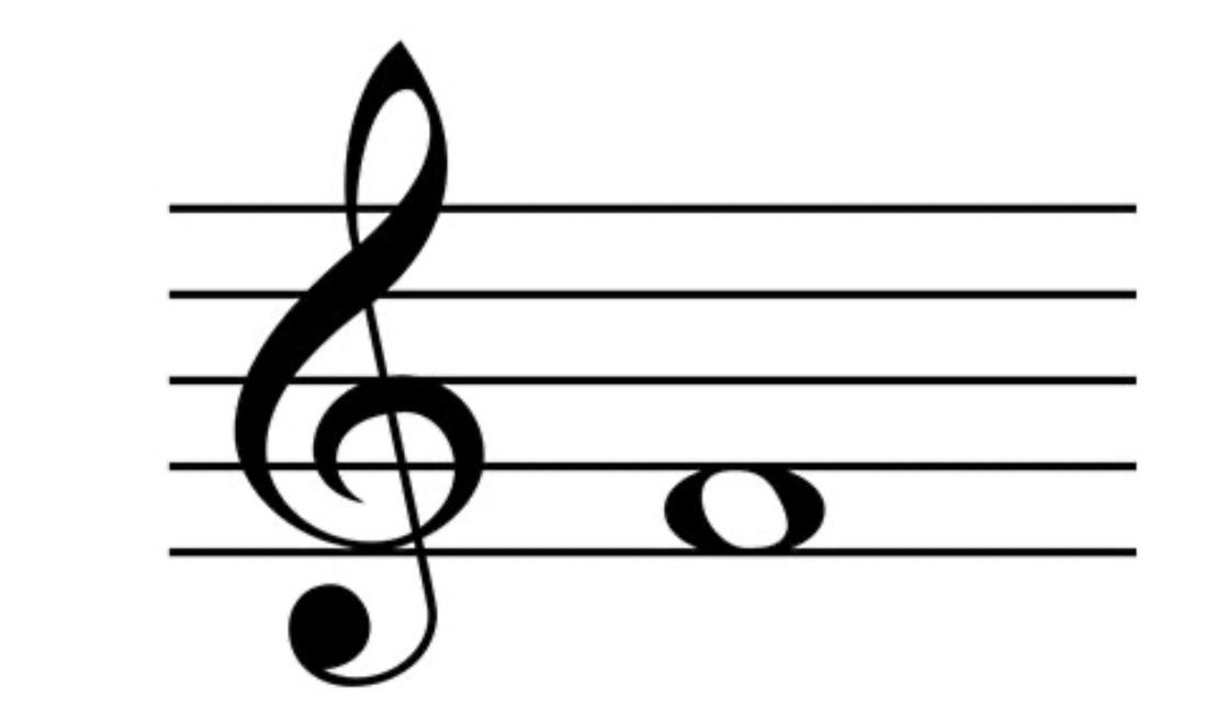 <p>What space is this on the treble?</p>