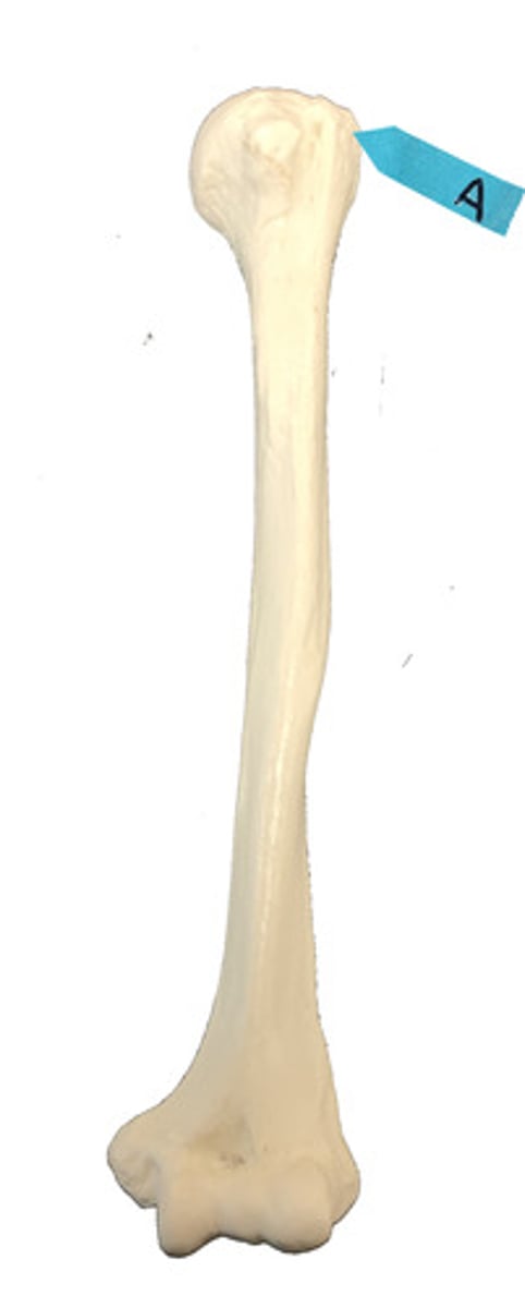 <p>Identify this bone marking.</p>
