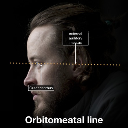 From the corner of the eye to the middle ear
