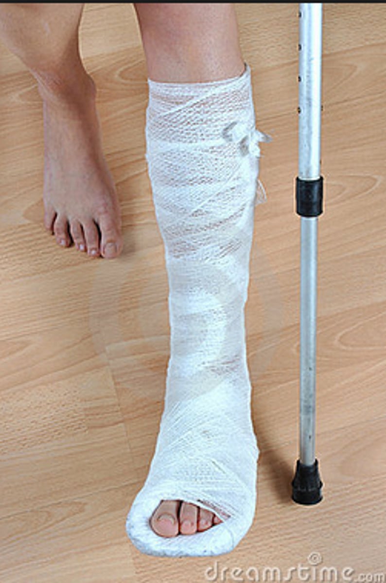 <p>я сломал ногу</p>