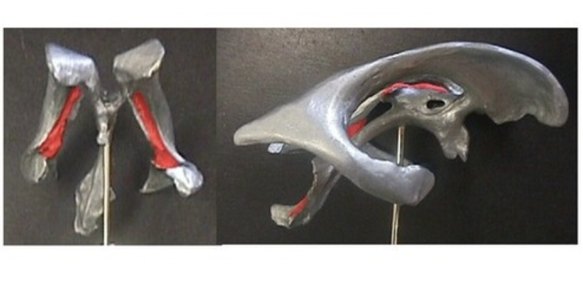 <p>body and inferior horn</p>