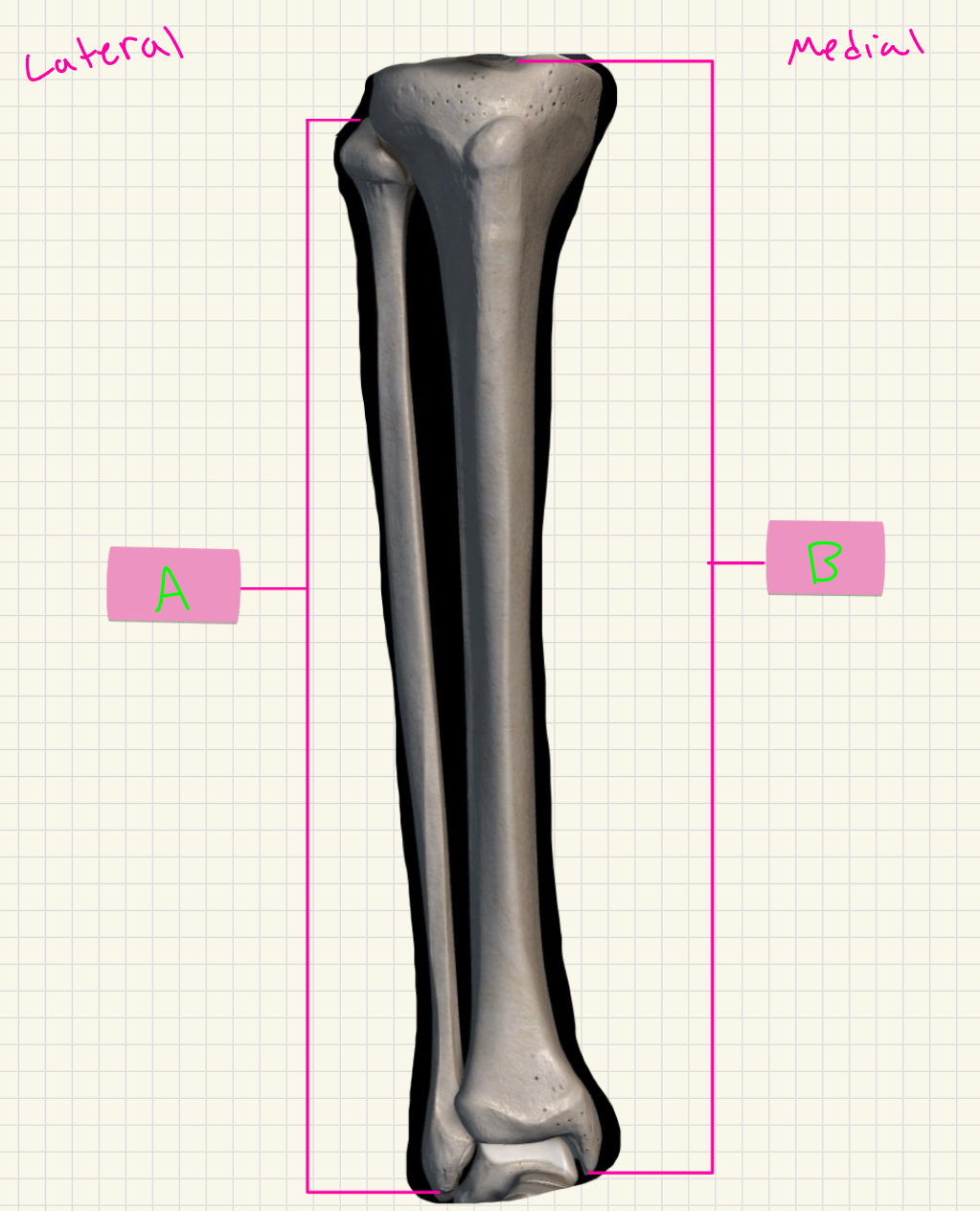 <p>What’s A-B? Whole bones!</p>