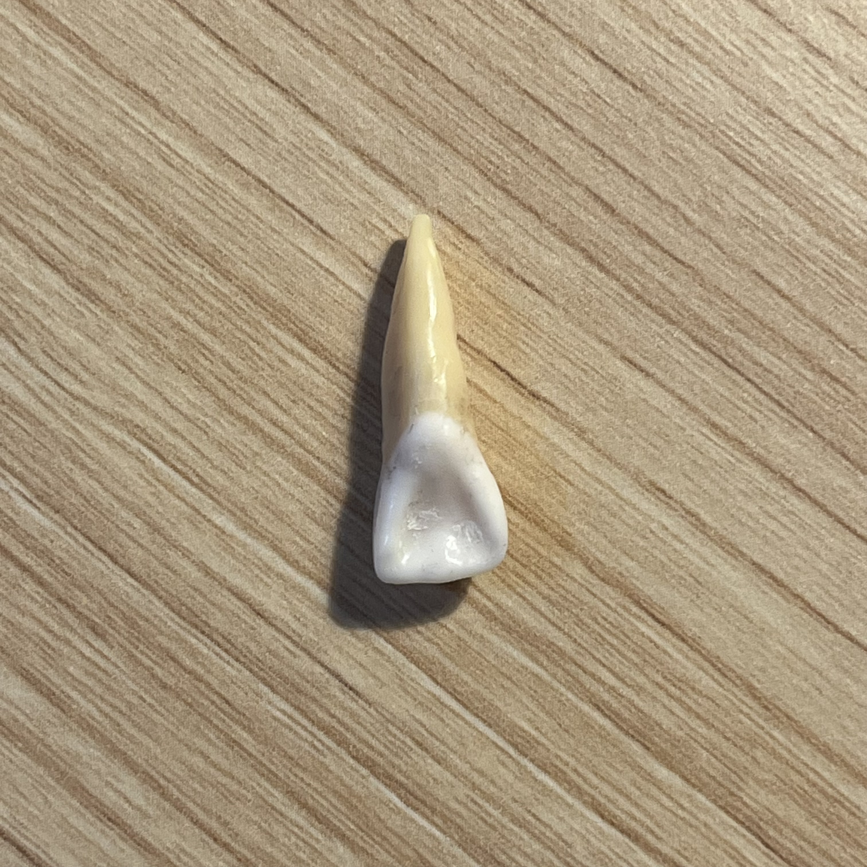 <p>What tooth is this (with view)?</p>