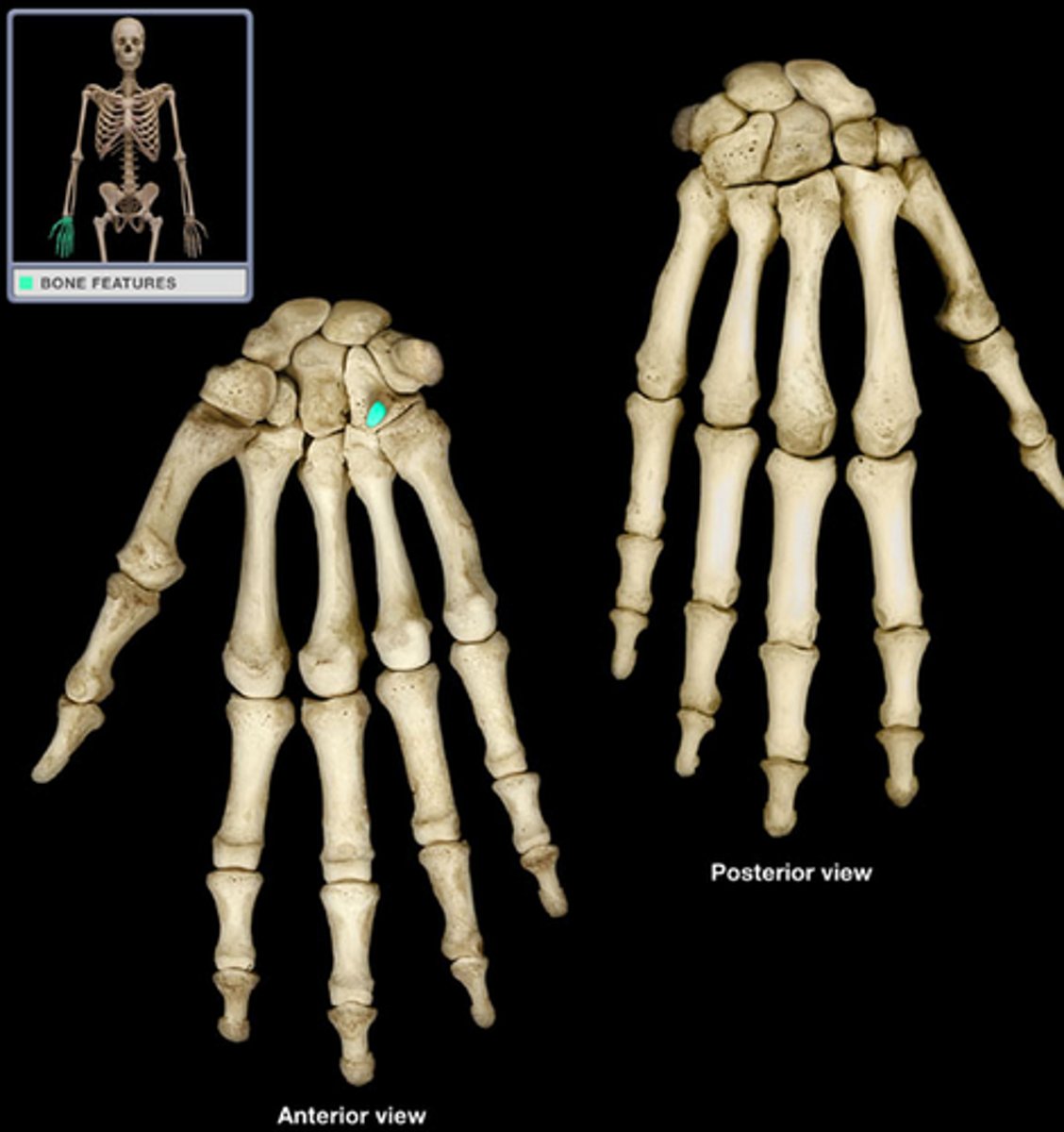 <p>Projection on hamate bone.</p>