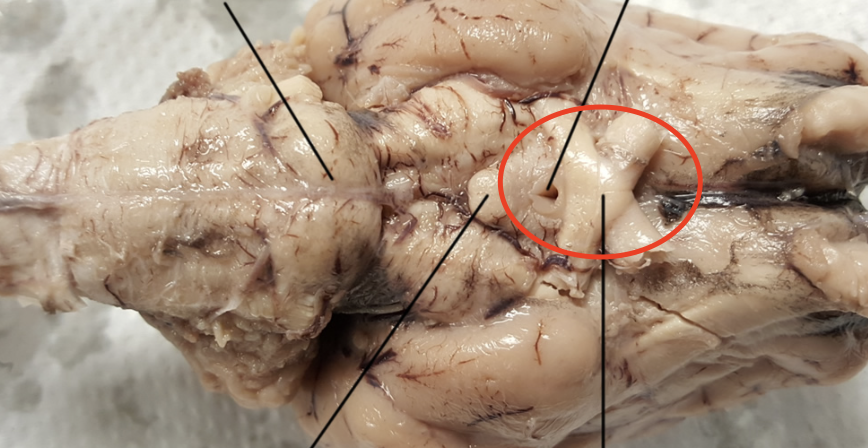 <p>Part of the brain where the optic nerves cross; importance for the visual pathway</p>