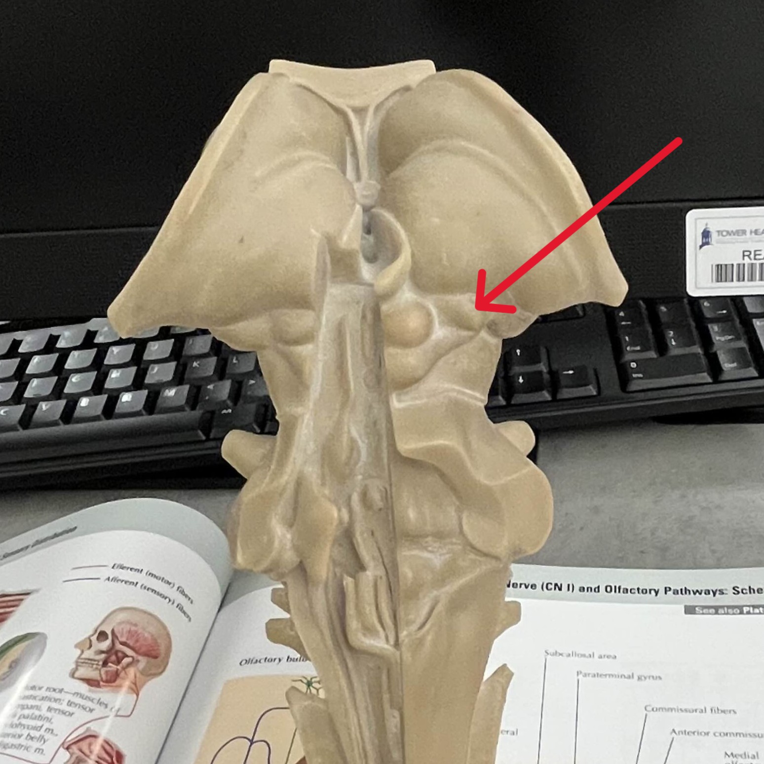 <p>Which part of the thalamus is:</p><ul><li><p>Posterior portion</p></li><li><p>Medial to lateral geniculate</p></li></ul><p></p>