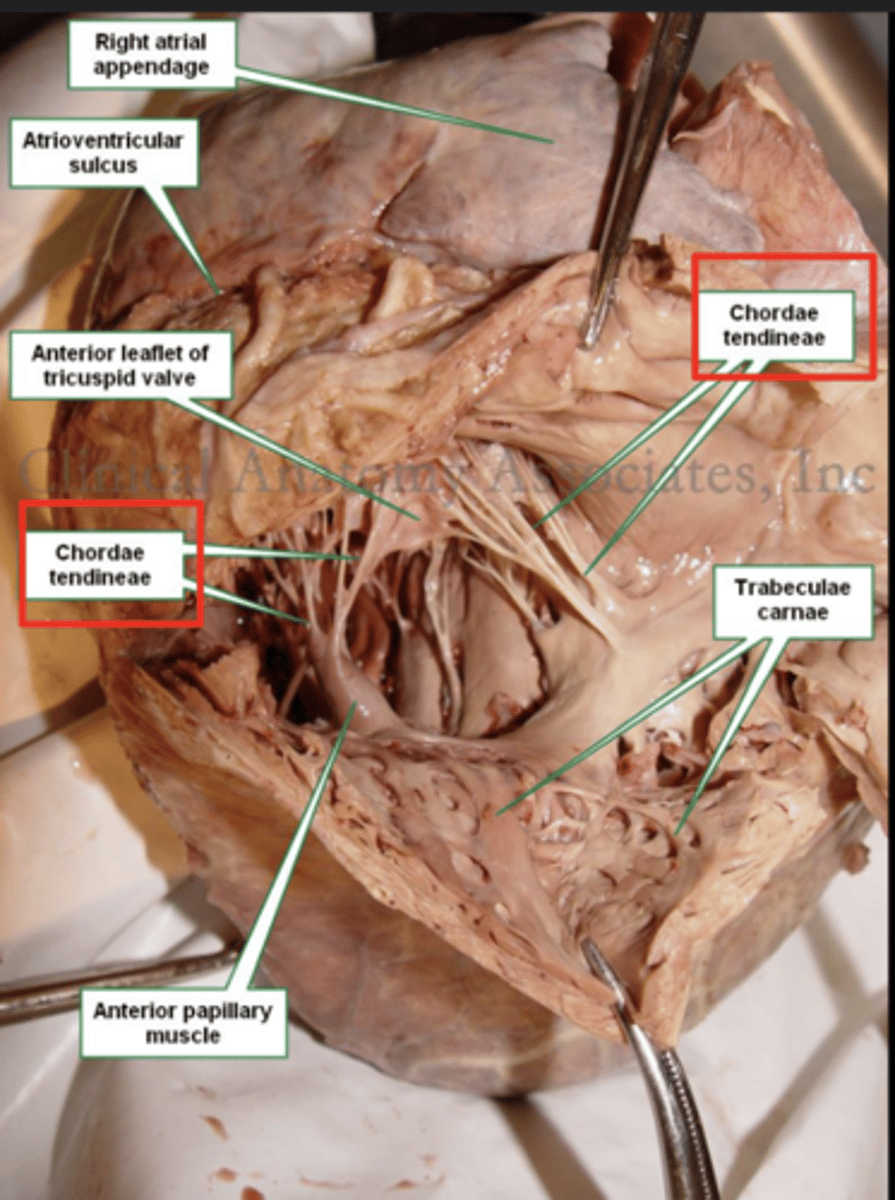 <p>Chordae tendinae</p>
