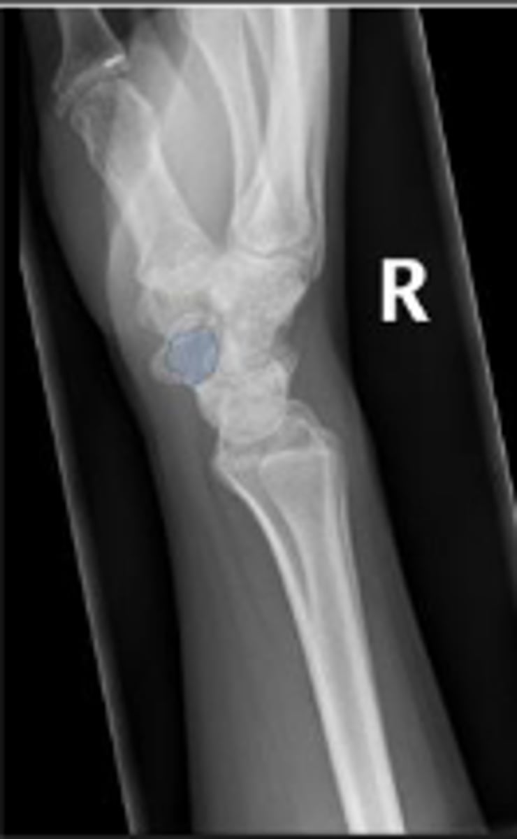 <p>What is the arow pointing to?</p>