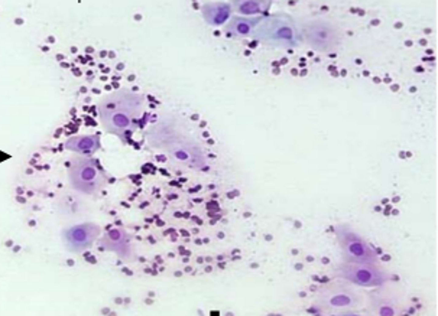 <p>cell numbers begin to increase due to estrogen-mediated proliferation of vaginal epithelium </p><p>predominant cell type = intermediate cells and red blood cells with fewer parabasal cells</p><p>increased ratio of large to small intermediates and superficial cells to large intermediates throughout stage</p><p>neutrophils may be present </p>
